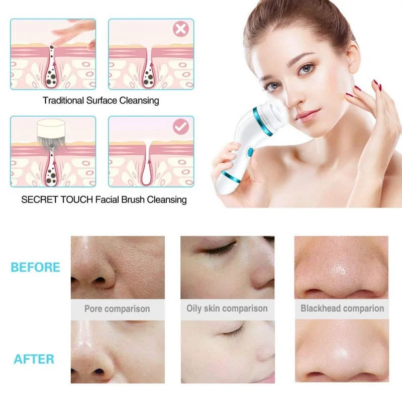 Sonic Facial Cleansing Brush, before and after images