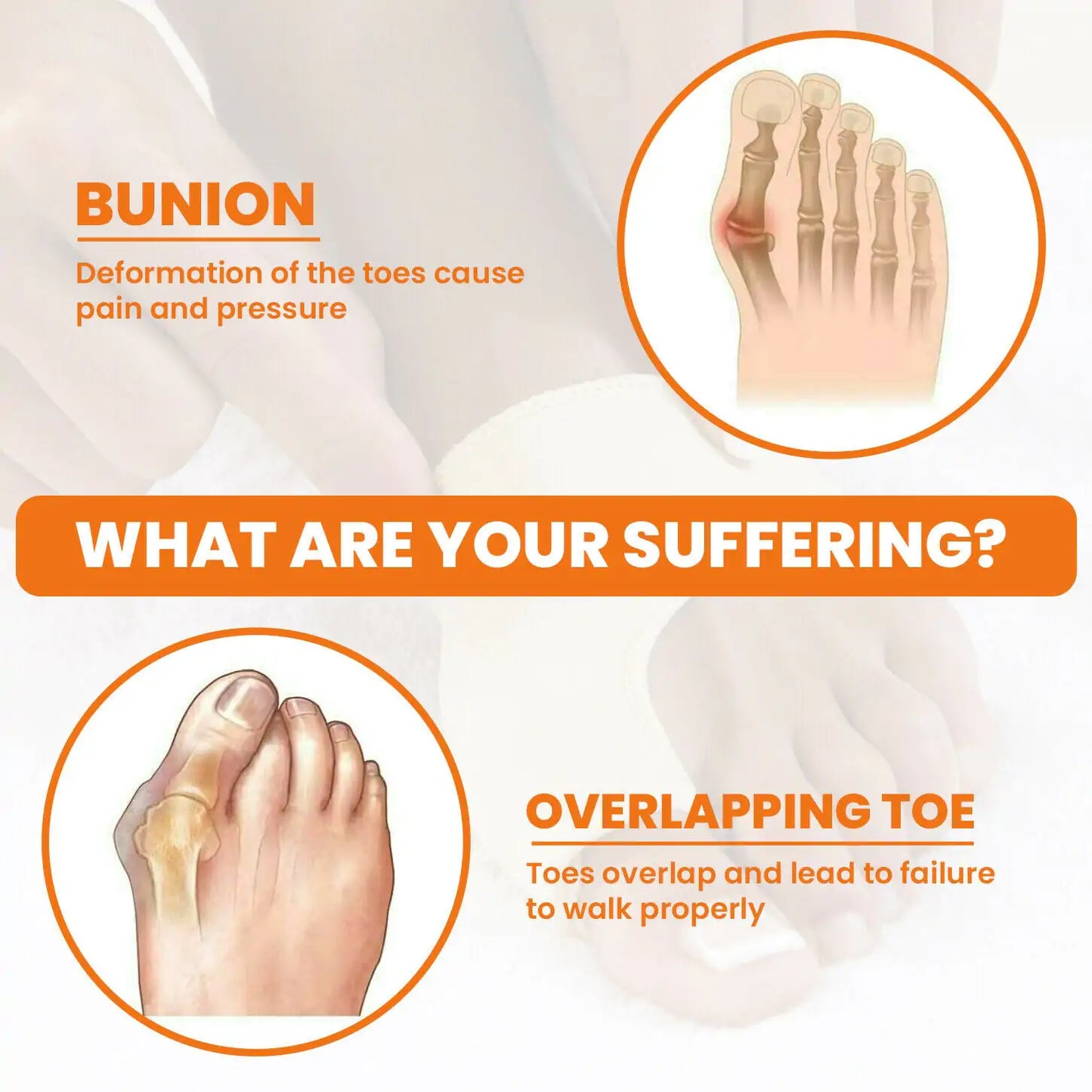 Bunion Splint Big Toe Straightener – Soft Gel & Cloth | Correct Hallux Valgus, Bunions, & Hammer Toes